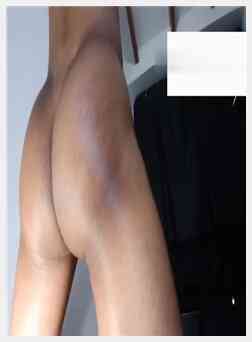 英国广播公司在线抽搐