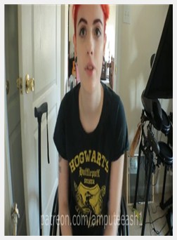 截肢者阿什-我是如何使用轮椅和假肢的